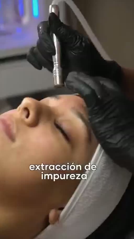 Cuadro 3 del anuncio de facial con microdermabrasión en spa