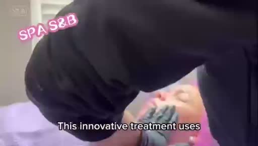 Cuadro 2 del anuncio de Tratamiento facial de plasma