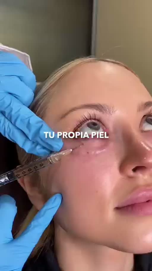 Cuadro 3 del anuncio de Tratamiento facial con PRP