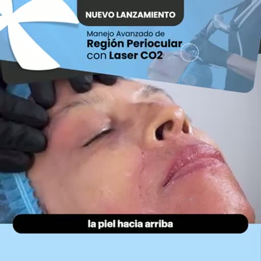 Cuadro 3 del anuncio de Curso de láser CO2 periocular
