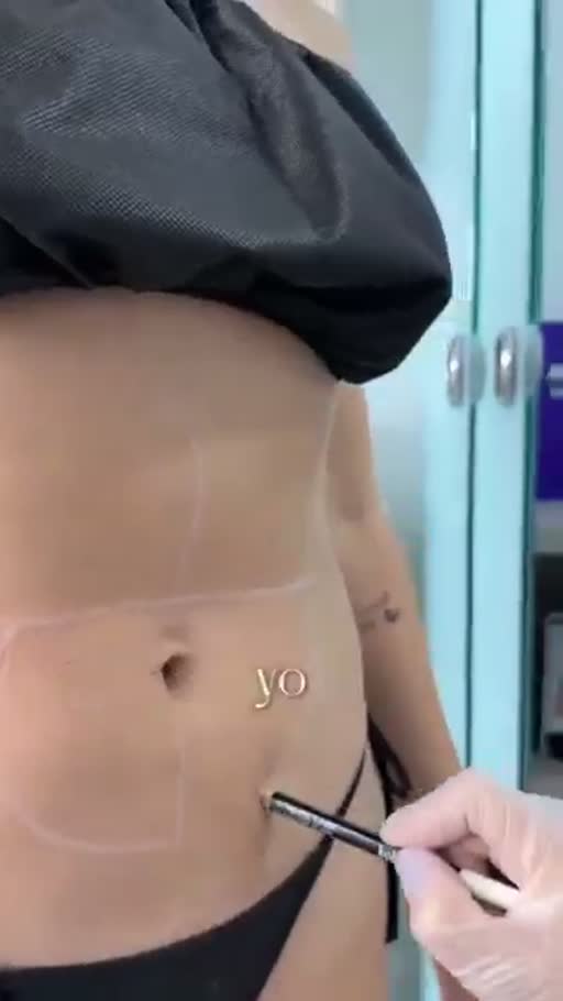 Cuadro 1 del anuncio de Tratamiento corporal reductor combinado