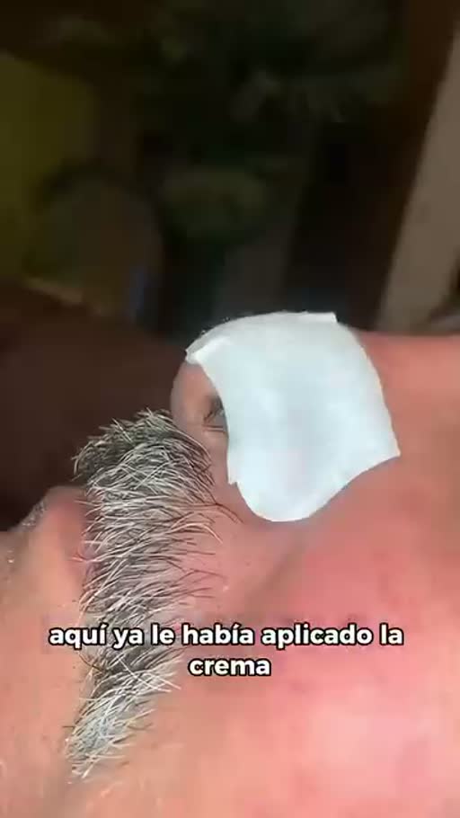 Cuadro 2 del anuncio de Mascarilla para puntos negros